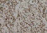 PBXIP1 Antibody in Immunohistochemistry (Paraffin) (IHC (P))