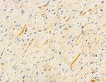 PBXIP1 Antibody in Immunohistochemistry (Paraffin) (IHC (P))