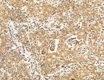 PBXIP1 Antibody in Immunohistochemistry (Paraffin) (IHC (P))