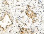PBXIP1 Antibody in Immunohistochemistry (Paraffin) (IHC (P))