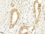 PBXIP1 Antibody in Immunohistochemistry (Paraffin) (IHC (P))