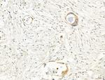 PBXIP1 Antibody in Immunohistochemistry (Paraffin) (IHC (P))