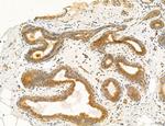 PBXIP1 Antibody in Immunohistochemistry (Paraffin) (IHC (P))