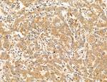 PBXIP1 Antibody in Immunohistochemistry (Paraffin) (IHC (P))