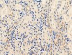 PBXIP1 Antibody in Immunohistochemistry (Paraffin) (IHC (P))