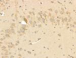 PBXIP1 Antibody in Immunohistochemistry (Paraffin) (IHC (P))