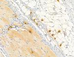 PBXIP1 Antibody in Immunohistochemistry (Paraffin) (IHC (P))