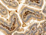 PBXIP1 Antibody in Immunohistochemistry (Paraffin) (IHC (P))