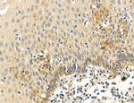 PBXIP1 Antibody in Immunohistochemistry (Paraffin) (IHC (P))