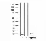 DSS1 Antibody in Western Blot (WB)
