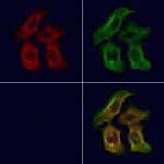 PEX16 Polyclonal Antibody