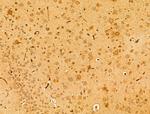 PEX16 Antibody in Immunohistochemistry (Paraffin) (IHC (P))