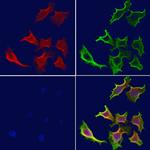 SNX17 Polyclonal Antibody