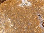 SYNPO2 Polyclonal Antibody