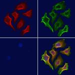 STX11 Polyclonal Antibody