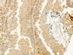 CYLD Polyclonal Antibody