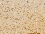 EXOC1 Antibody in Immunohistochemistry (Paraffin) (IHC (P))