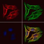 GSTA4 Polyclonal Antibody