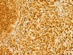 OIP5 Antibody in Immunohistochemistry (Paraffin) (IHC (P))