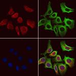 ACADVL Polyclonal Antibody