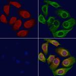 BBS7 Polyclonal Antibody