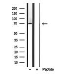 BBS7 Antibody in Western Blot (WB)