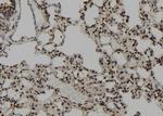 CEP164 Polyclonal Antibody