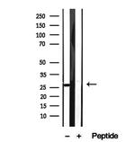 CHCHD3 Antibody in Western Blot (WB)
