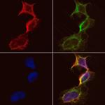 CKMT1A Polyclonal Antibody