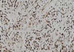 CPSF4 Polyclonal Antibody