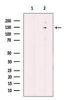 DHX38 Antibody in Western Blot (WB)