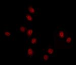 DYX1C1 Polyclonal Antibody