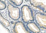 IVD Polyclonal Antibody