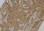 KIF18A Polyclonal Antibody
