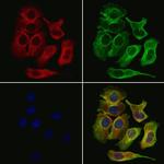 MYO18A Polyclonal Antibody