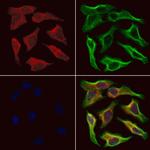 NDUFB11 Polyclonal Antibody