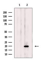 NDUFB11 Antibody in Western Blot (WB)
