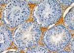 NDUFS7 Antibody in Immunohistochemistry (Paraffin) (IHC (P))