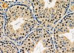 NUFIP1 Polyclonal Antibody