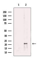 Rap1B Polyclonal Antibody