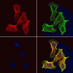 ARHE Polyclonal Antibody