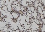 RQCD1 Antibody in Immunohistochemistry (Paraffin) (IHC (P))