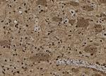 SNRPB2 Antibody in Immunohistochemistry (Paraffin) (IHC (P))