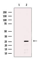 SNRPB2 Antibody in Western Blot (WB)