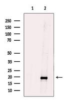 TIMM17B Polyclonal Antibody