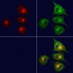 TIMM44 Polyclonal Antibody