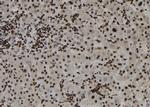 ZC3HAV1 Polyclonal Antibody
