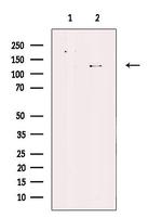 ATP8A1 Polyclonal Antibody