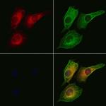CFHR3 Polyclonal Antibody
