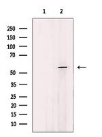 CFHR3 Antibody in Western Blot (WB)